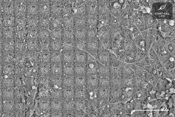 Une image au microscope électronique à balayage de DishBrain