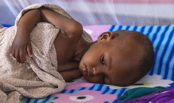 Des organisations caritatives fournissent des soins spécialisés pour soigner les enfants souffrant de malnutrition
